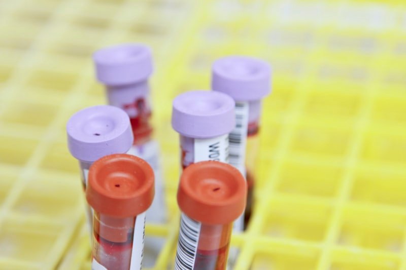 Lancet Publishes Landmark Data on AI-Assisted Prostate Cancer Immunotherapy