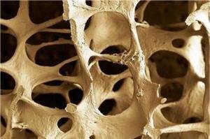 A New Way to Build Stronger Bones: Blocking Axl Shows Promise