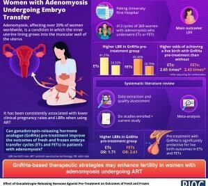 Peking University Researchers Report That Hormone Pre-Treatment May Improve Live Birth Rates in Women with Adenomyosis