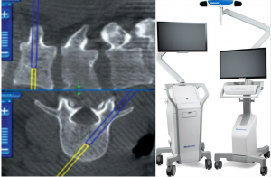Guntur neurosurgeon urges spine care to count lost wages, caregiver time, not just bills – image 4